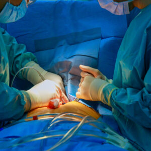 Cardiovascular & Thoracic Surgery CAQ Examination Prep Course